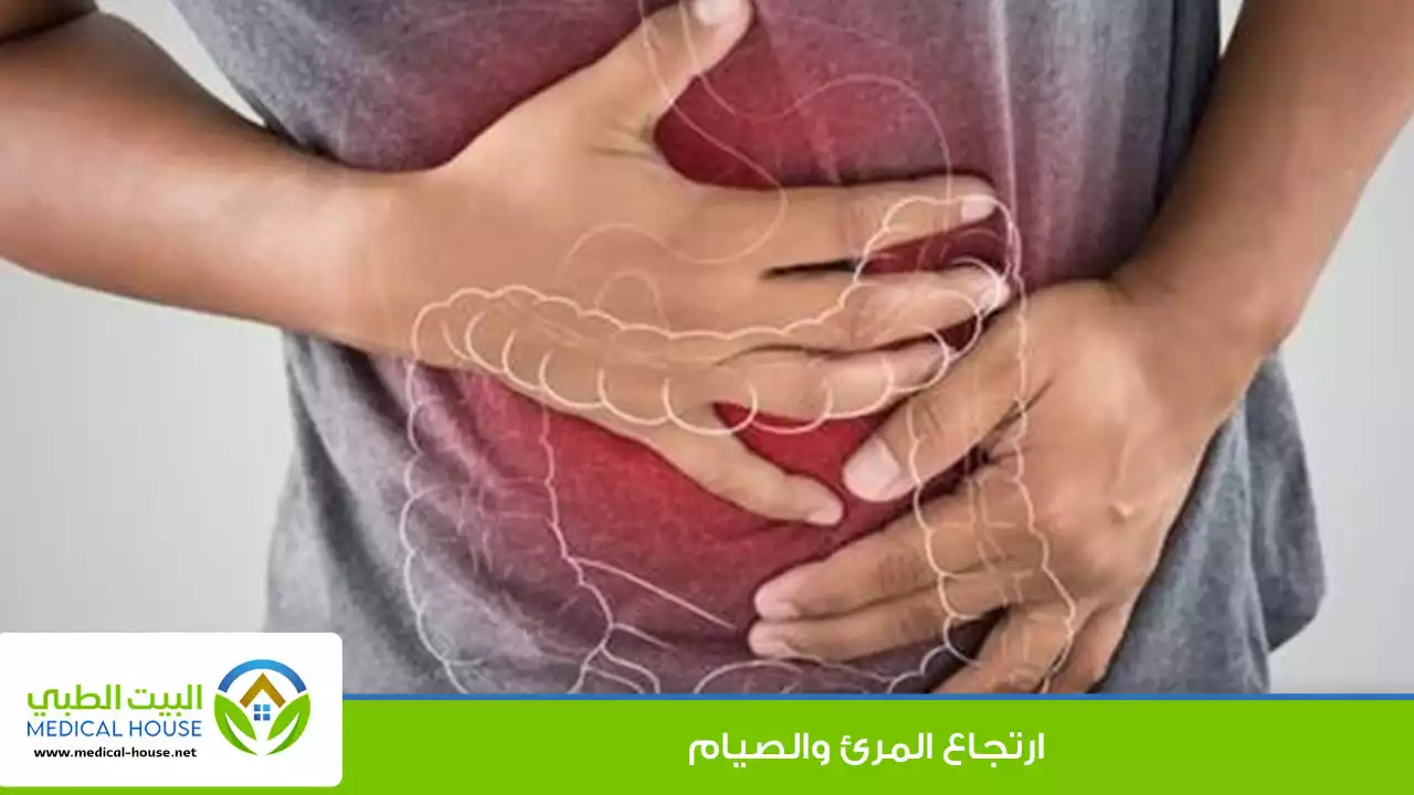 ارتجاع المرئ والصيام