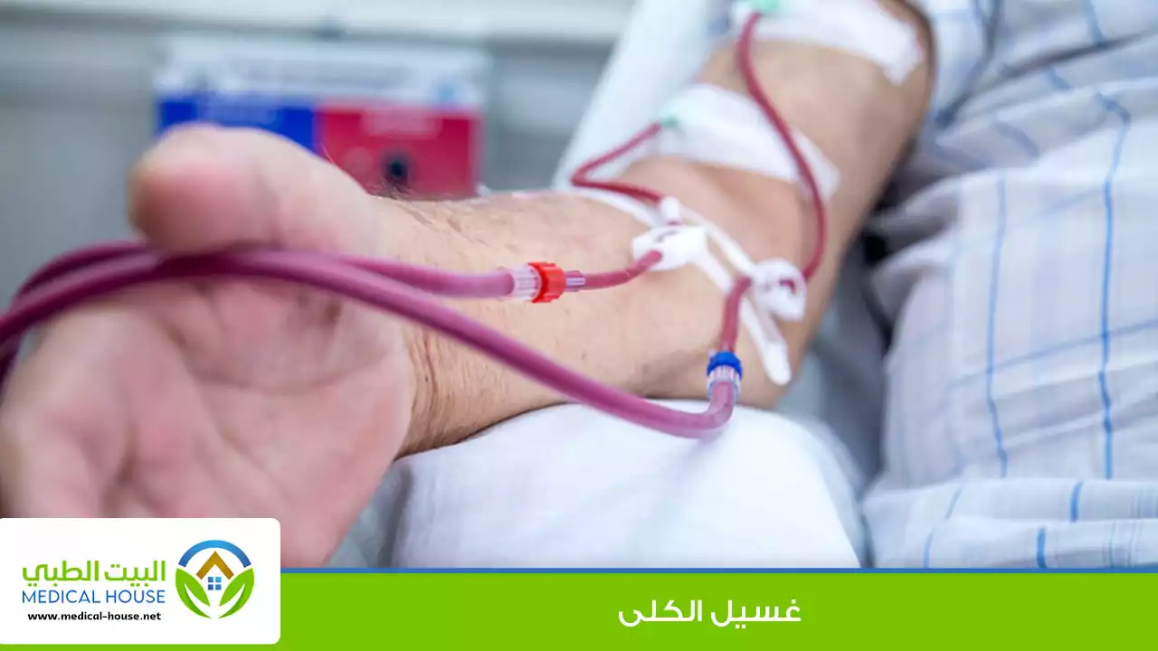 انواع الغسيل الكلوي وآلية عمل كل نوع