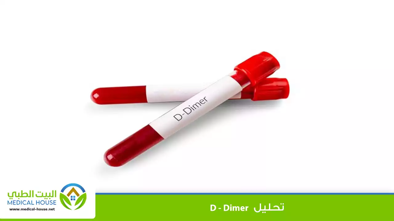 ما هو تحليل D-dimer